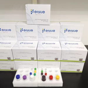 Human sRAGE(soluble Receptor for Advanced Glycation End product) ELISA Kit