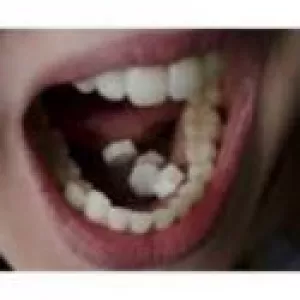 SAFE ABORTION PILLS WITH NO PAINS IN ANTIGUA +27738432716