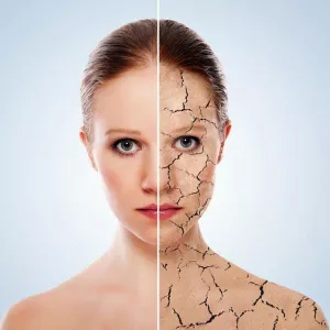 Лечение псориаза и витилиго в клинике Дженерал Медикал Центр