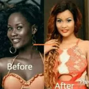 @G.m.x%+27695222391 J17@ South africa@BEST face &body whitening cream, Dark Spots/ Stretch Marks. pills, injection in Vereeniging, Orange Farm Johannesburg Lenasia Midrand Randburg Germiston Benoni Boksburg, r