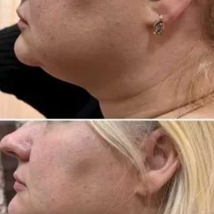 Косметолог-естет.