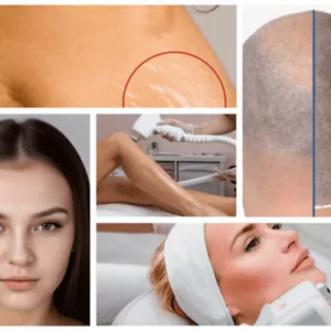 Перманентный макияж в Москве от Натальи Удовиченко: авторская методика