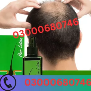 Neo Hair Lotion Price in Sargodha 03000680746
