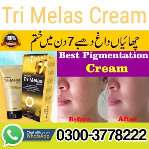 Tri Melas Cream Price In Pakistan 03003778222