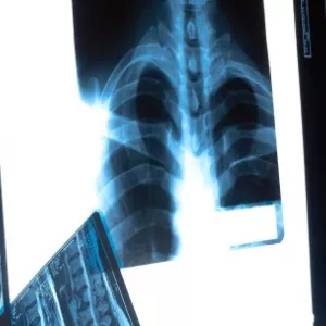 МРТ в Києві в діагностичному центрі RADI