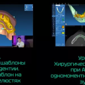 Образовательный курс по хирургическим шаблонам в программе RealGuide