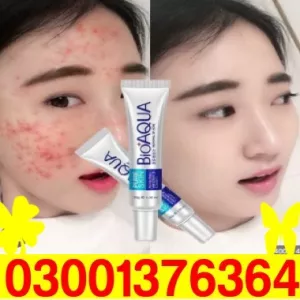 Bioaqua Anti Acne Cream 30g in Pakistan ~ 03001376364 ! Cash