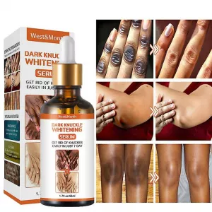 Dark Knuckle Whitening Serum In Leeds City in England, Elbow And Knee Brightening Serum In Picayune City in Mississippi, Get Rid Of Fire & Scars In Saldanha Town, Get Rid Of Tattoos And Dark Spots In Montagu Town In South Africa
