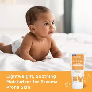 Hyland’s Naturals Baby Eczema Lotion 5 oz (142 g)